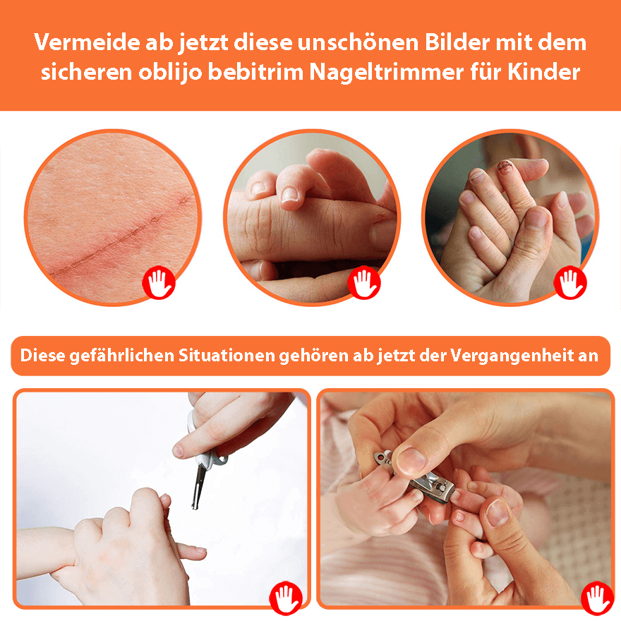 oblijo bebitrim - Nageltrimmer für Babies und Kleinkinder - einfach und sicher!